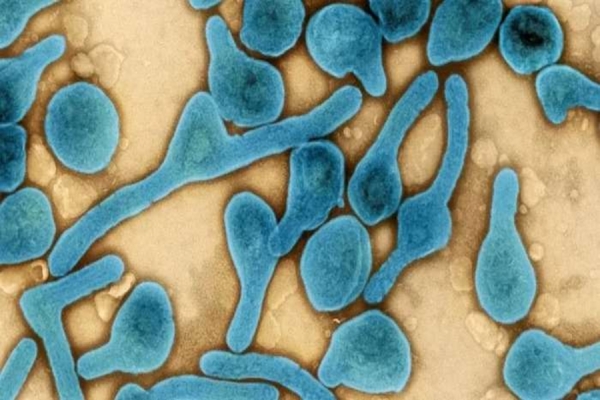 Vírus de Marburg dificilmente sairá da África por alta letalidade, afirma Vecina
