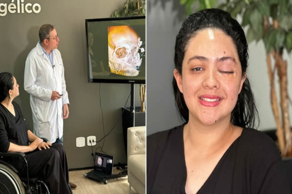 Cirurgia inédita no Brasil para reconstrução facial é realizada em Londrina